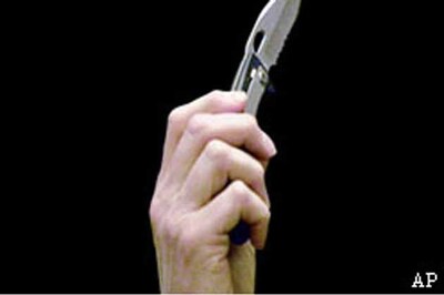 Sea urchins: Knives that never need sharpening