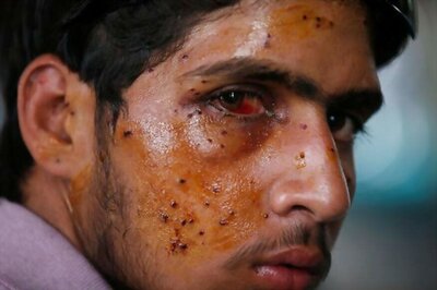 MHA Forms Expert Committee to Explore Alternative to Pellet Guns