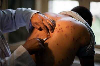 J&K HC Refuses to Ban Pellet Guns, Cites Mob Violence in Valley