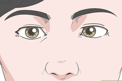 How to Treat Crossed Eyes