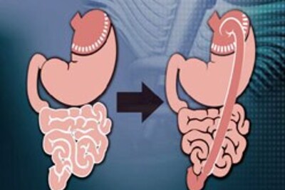 Obesity is all in your gut