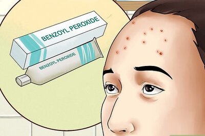 How to Get Rid of Forehead Acne