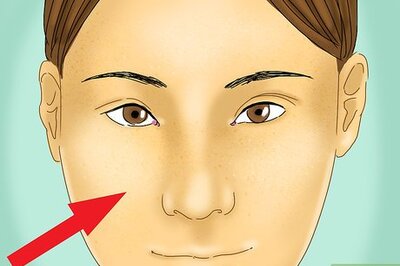How to Get Rid of Blackheads and Whiteheads Using Commercial Products