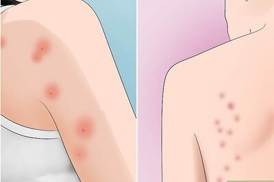How to Avoid Insect Bites While Sleeping