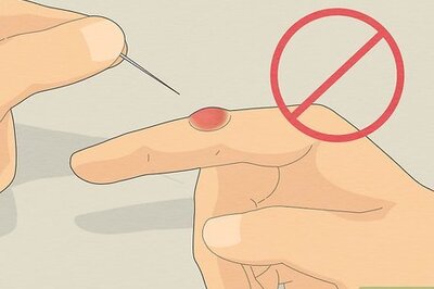 Blood Blister Treatment Plus Causes and When to See a Doc