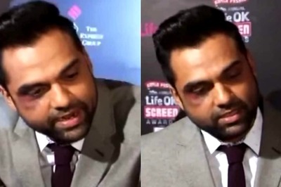 When Abhay Deol Walked Red Carpet With Black Eye: 'Music Company Se Maar Kha Ke Aa...'