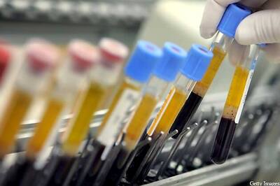 Chennai couple seek a sperm donor from IIT