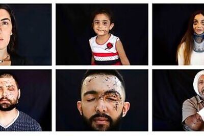 AP PHOTOS: Scars from Beirut blast capture moment of horror
