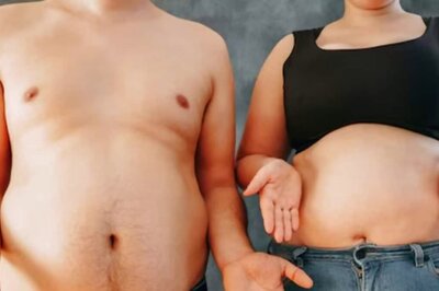 Fat Accumulates Differently In Men And Women's Bodies: Study