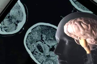 Brain-Eating Amoeba Kills 50-Year-Old Man In South Korea, Here's What Happened