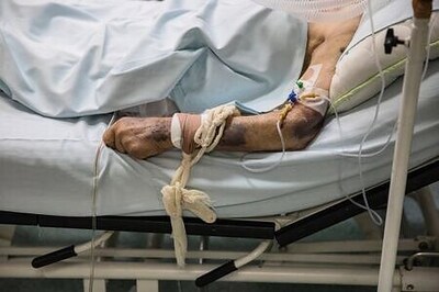 Some COVID-19 survivors suffer psychiatric disorders, Italian study says