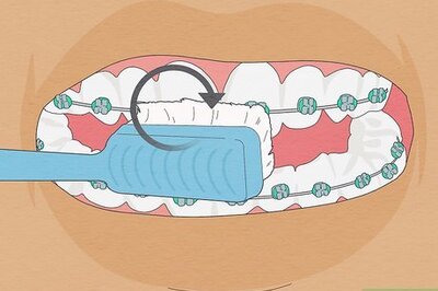 How to Brush Your Teeth With Braces On