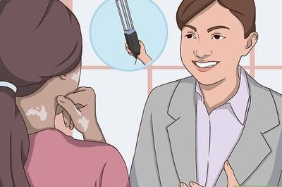 How to Prevent Vitiligo from Spreading