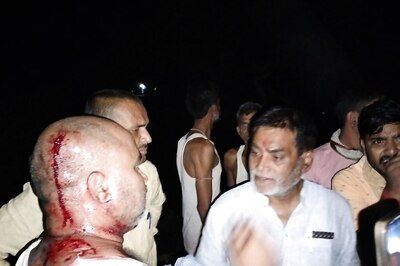 BJP Leader Ram Kripal Yadav Attacked By Unidentified Assailants In Bihar, Says He's Safe