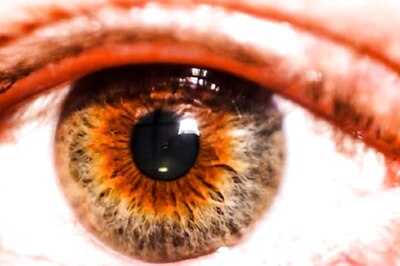 Delhi NCR Reports Uptick in Conjunctivitis Cases Amidst Relentless Monsoon Rains