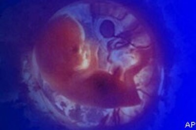 Womb transplant may be a reality one day