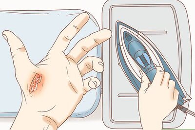 How to Treat a Burn from an Iron