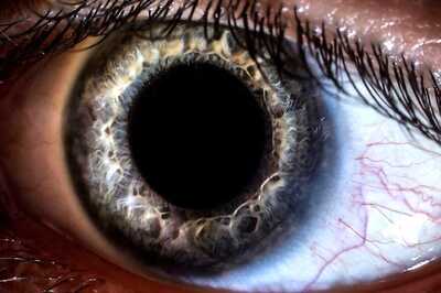 New Therapy For Macular Degeneration Shows Promise