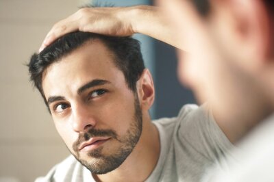How To Prepare And Plan If You Want To Opt For A Hair Restoration Procedure