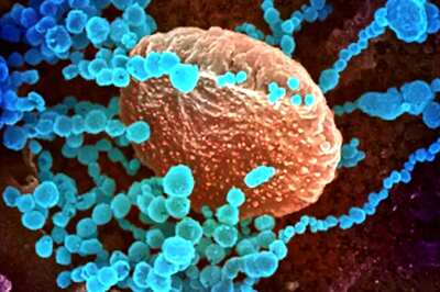 Chapare Virus: All You Need to Know About the Rare Ebola-like Virus