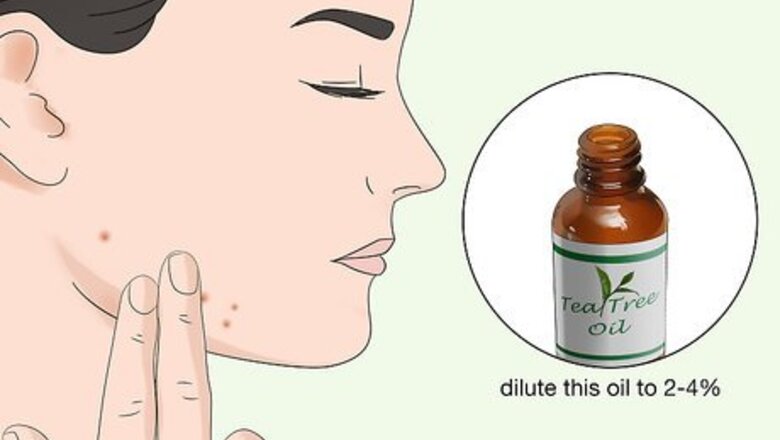 How to Treat Acne: Can Herbal Remedies Help?
