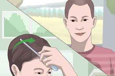 How to Hide Alopecia