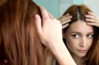 4 Natural Remedies To Reduce Hair Fall