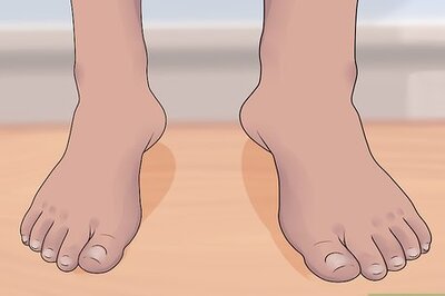 How to Recognize and Prevent Lymphatic Filariasis