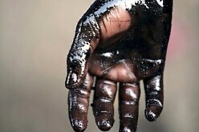 Read your hands to know your diseases