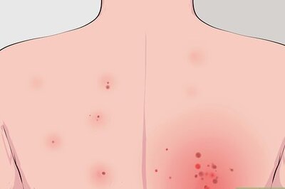 How to Buy a Medical Alert Bracelet