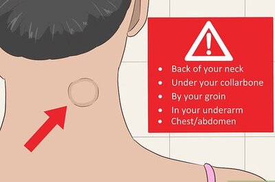 How to Diagnose Castleman Disease