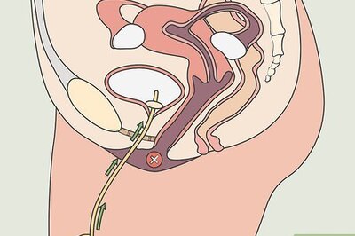 How to Unblock a Catheter