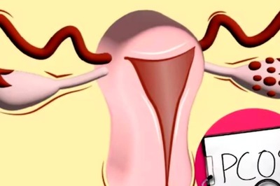 How This Woman Lost 14 Kg In Two Years Without Compromising On Her Diet