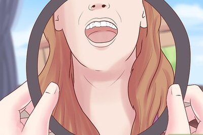 How to Recognize Thrush Symptoms (Oropharyngeal Candidiasis)