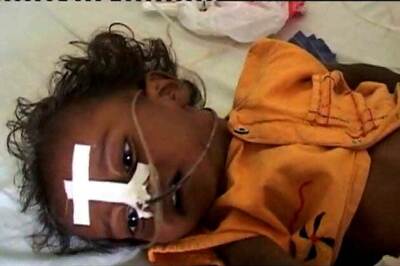 Encephalitis claims three more lives in Gorakhpur, toll reaches 576