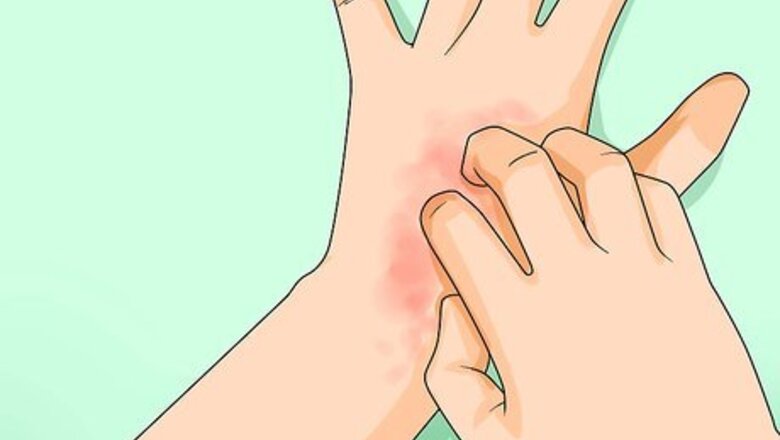 How to Know if You Have Sensitive Skin