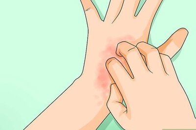 How to Know if You Have Sensitive Skin