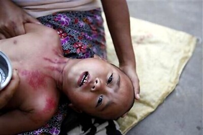 '7 pc anti-malarial drugs sold in India fake'