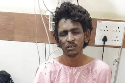 ​Phosphorus from Match Sticks, Items from Amazon: Recipe for Mangaluru Disaster | Explosive Details on IED