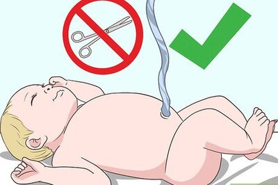 How to Cut the Umbilical Cord of a Baby