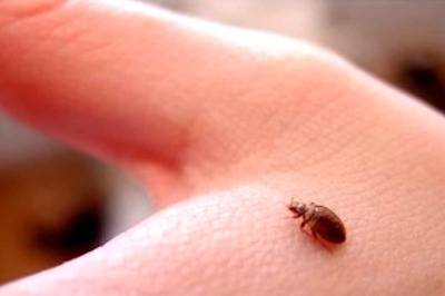 Woman’s 70th Birthday On Cruise Turns Ugly After Being Bedbugs Attack