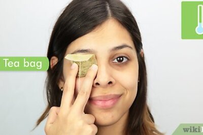 How to Get Rid of Dark Circles Under Your Eyes Without Makeup