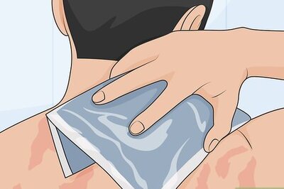 How to Control Psoriasis