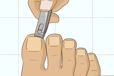 How to Hide Nail Fungus