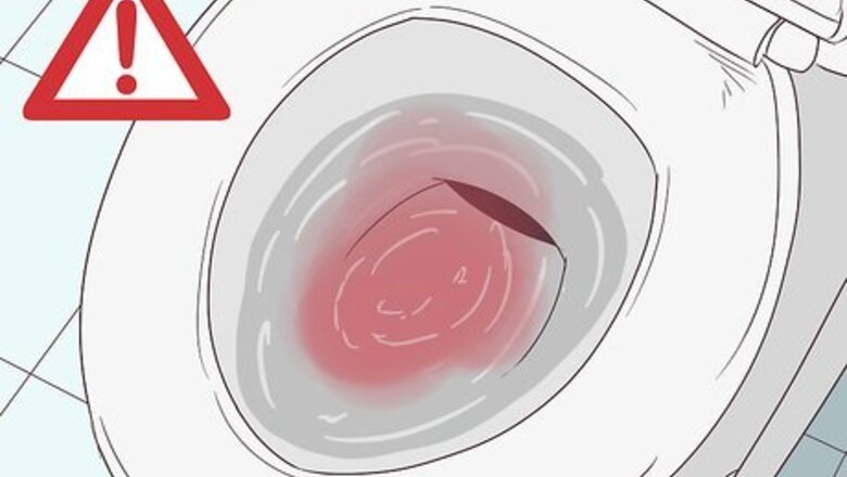 How to Treat Hematuria