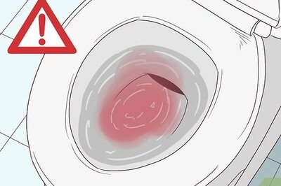 How to Treat Hematuria