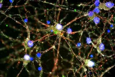 Reason behind mental disorder Schizophrenia found, may lead to ways to treat it