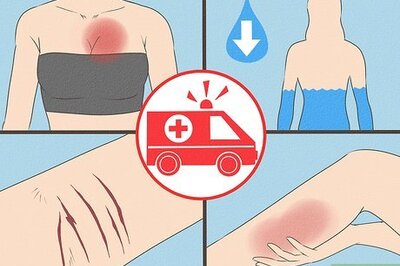 How to Beat Anorexia