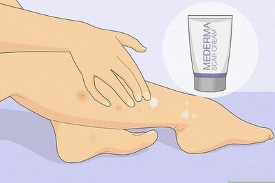 How to Remove Scars on Legs: Expert-Backed Tips