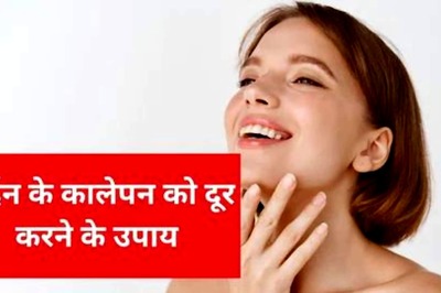 4 Easy and Quick Home Remedies to Get Rid of Dark Neck
